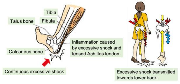 inside achilles pain