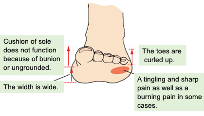 sharp shooting heel pain